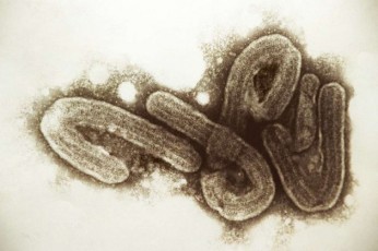 virus-fievre-ebola